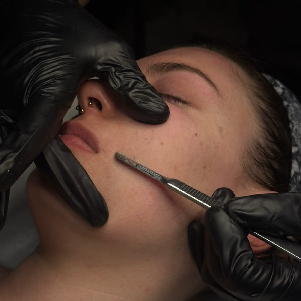 Dermaplane Facial at Esthetics by Emily in Centerville, OH