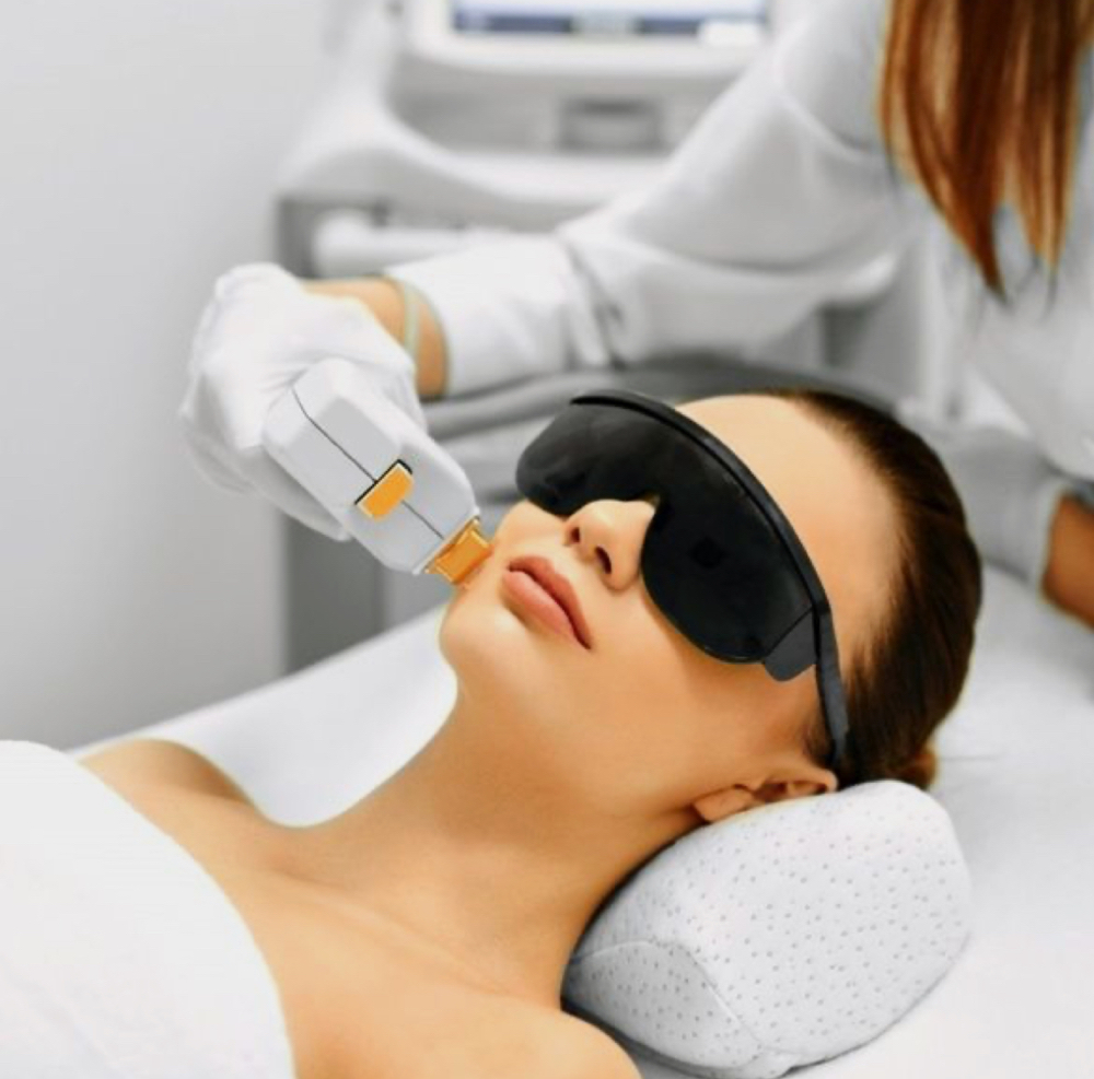 Erbium Resurfacing Face