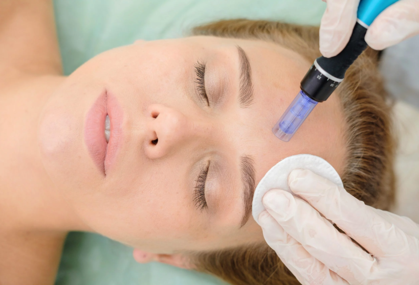 Microneedling Facial at Tae’s Esthétique Lounge in Jacksonville NC, NC