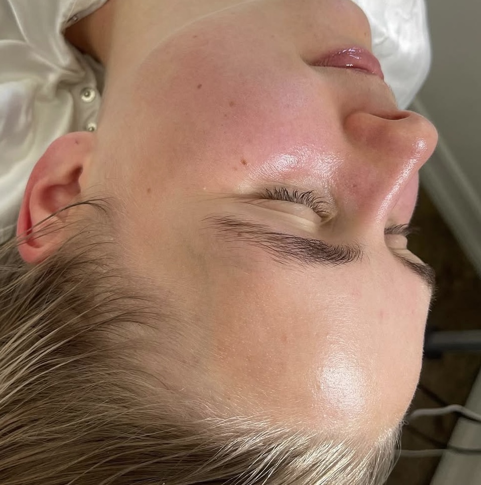 Signature Glass Skin Facial