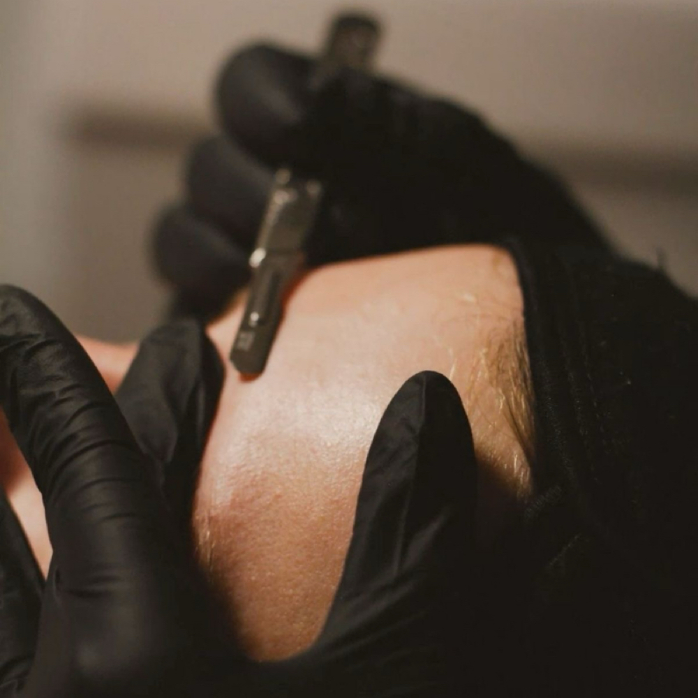 Silk Skin Treatment at Skin Sanctuary in Las Vegas, NV