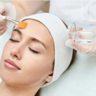 Chemical Peel Enhancement at Dreamland Health and Wellness in Indianapolis, IN