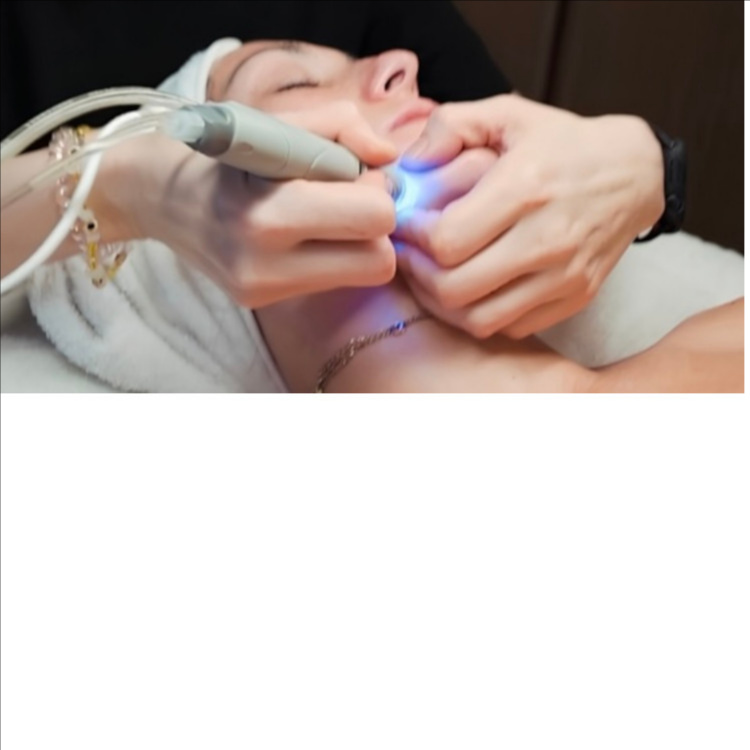 The Hydro Diamond Ritual at Liz Mier Skin in Lake Wales, FL