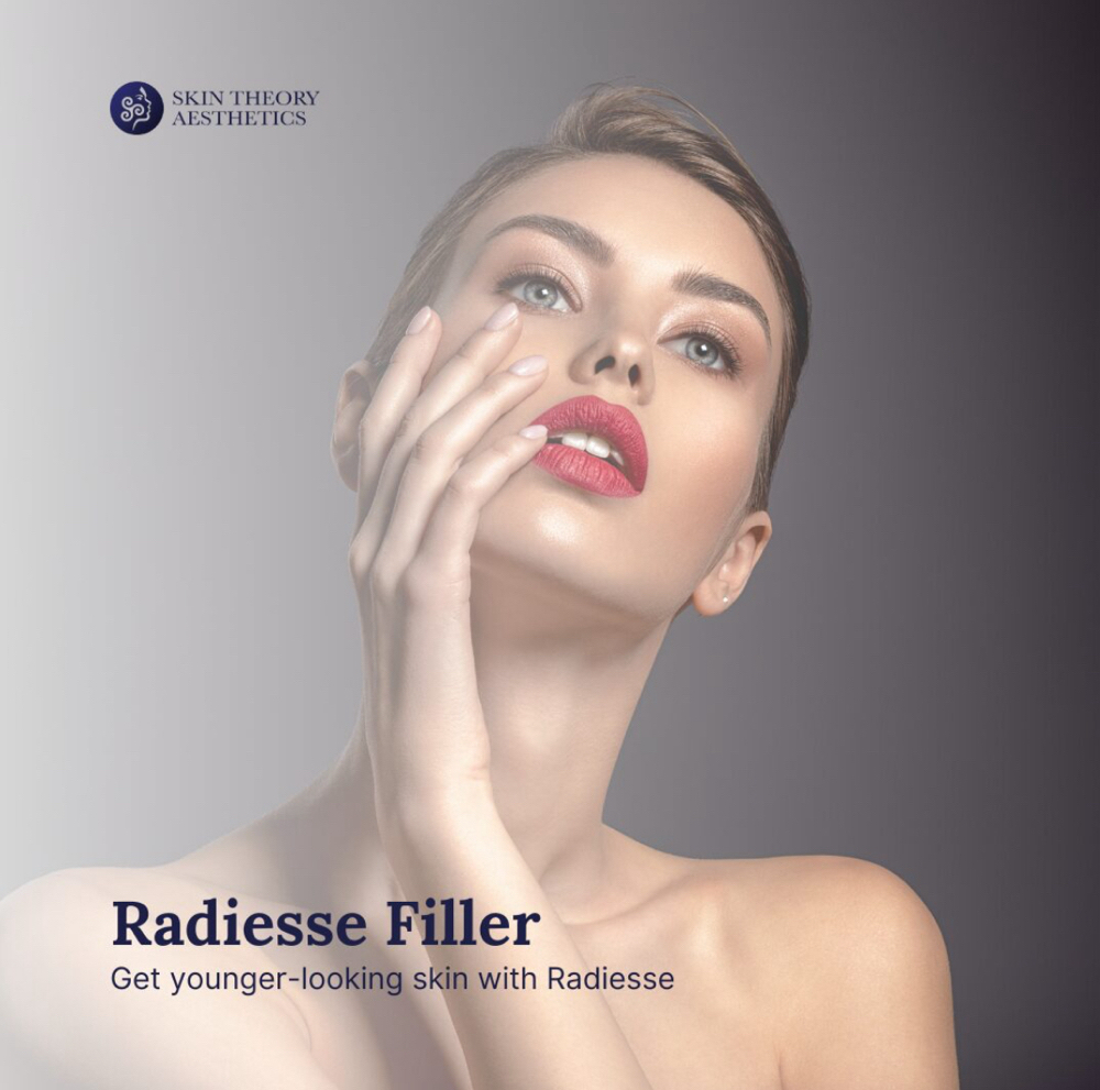 Radiesse Filler