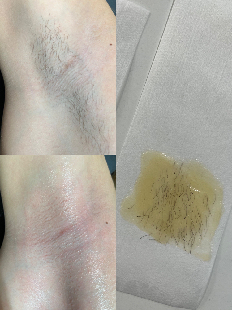 Underarm Wax