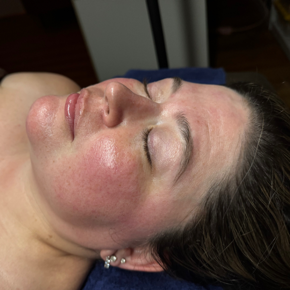 Virtual Skin Consultation at Satin Skin Esthetics LLC in Glens Falls, NY