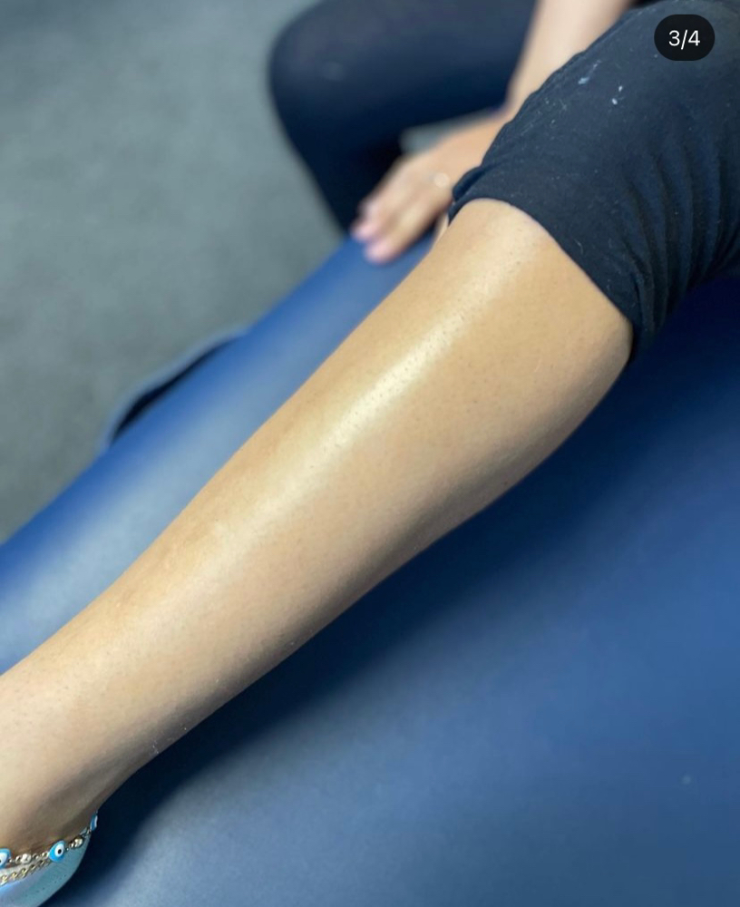 Full Leg