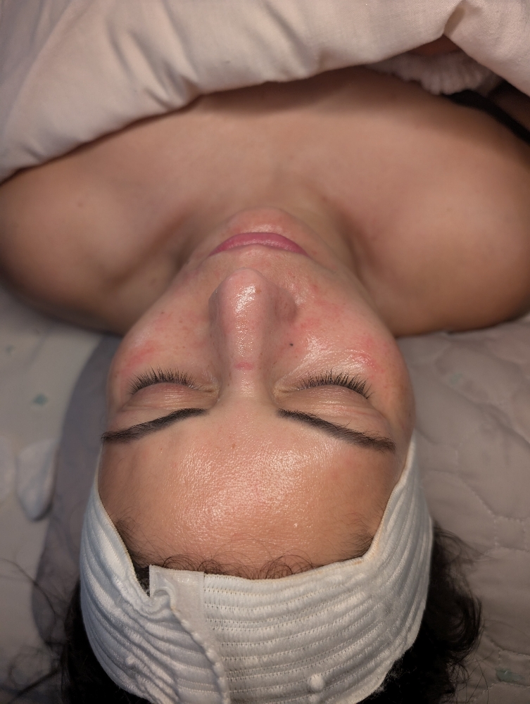 Glow & Go Peel