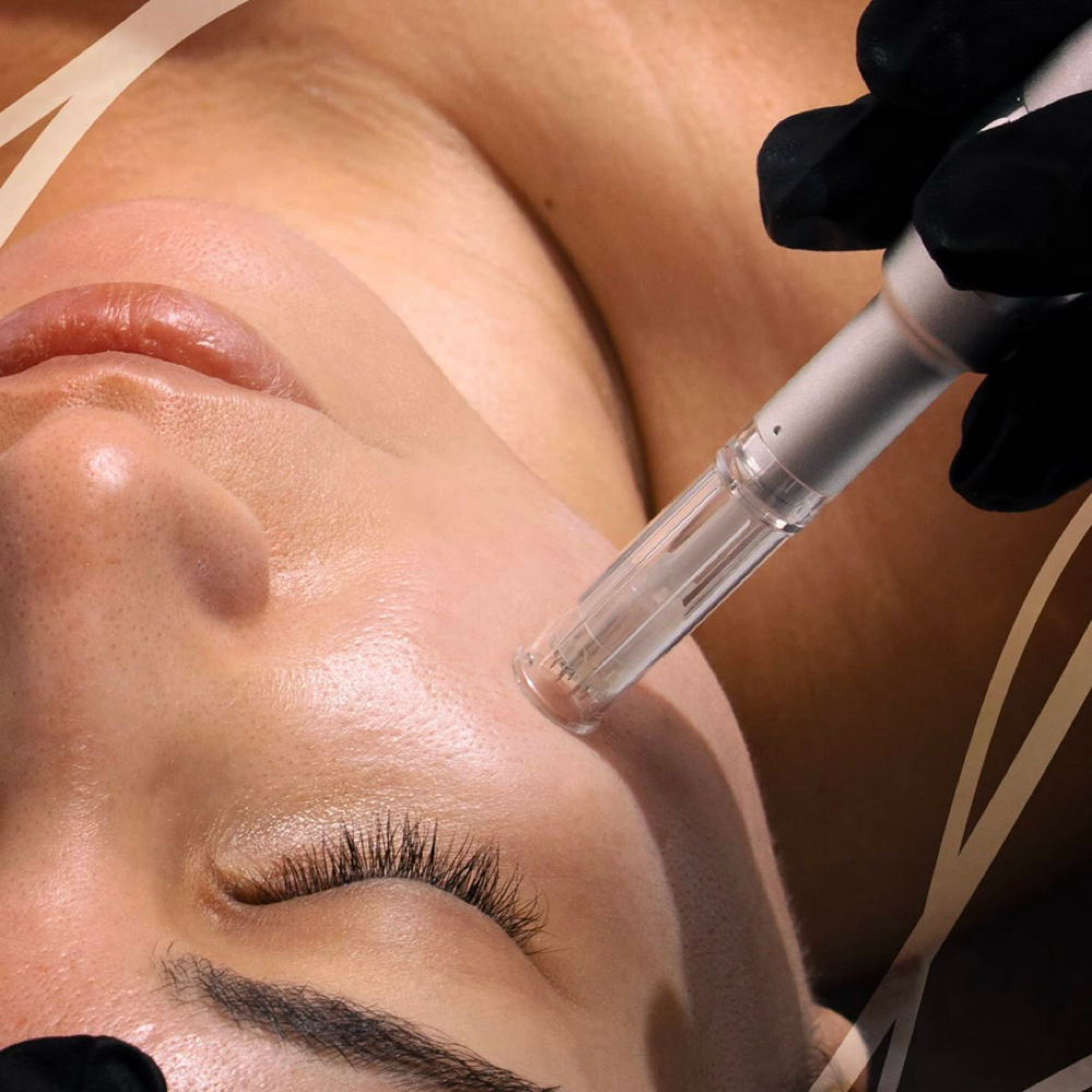 Microneedling