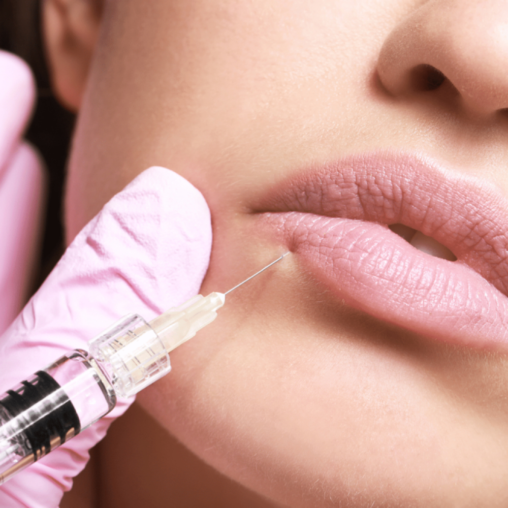 Lip Filler (full Syringe) at The Boujee Beauty in Burnet, TX