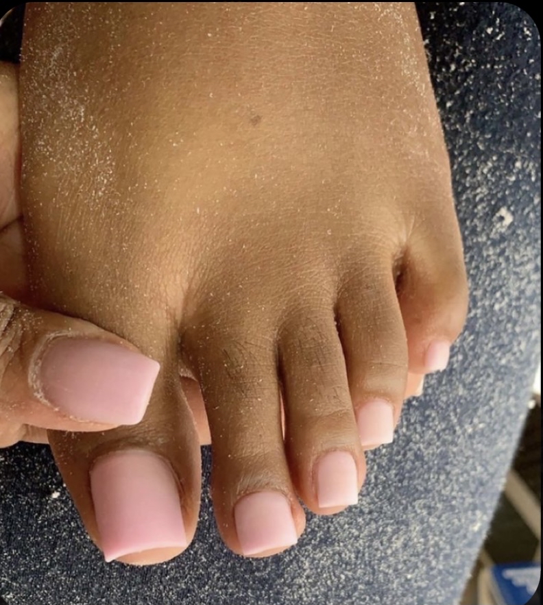 two big toes nails acrylic