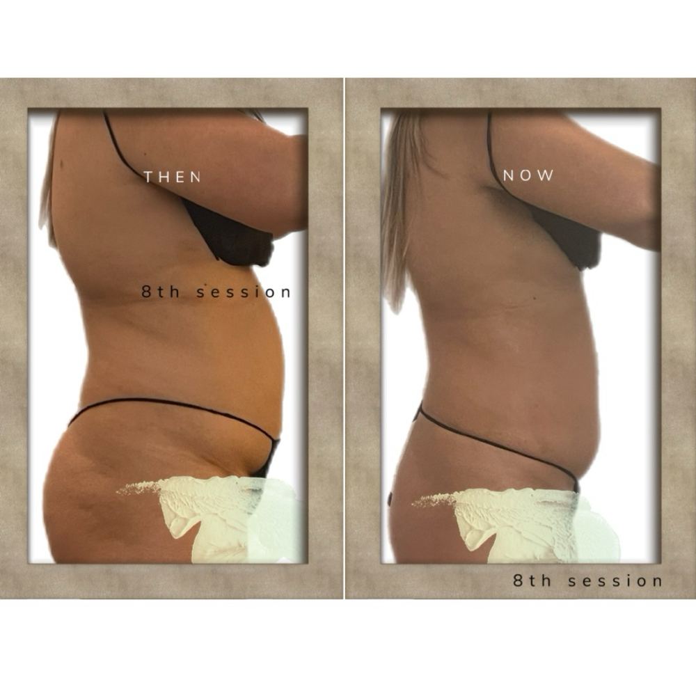 Body Cavitation Buy 5 Get 2