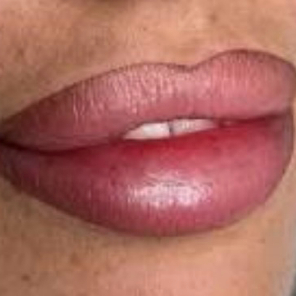 Lip Liner P.M.U at Beat-iFul Aesthetics in Hollywood, FL