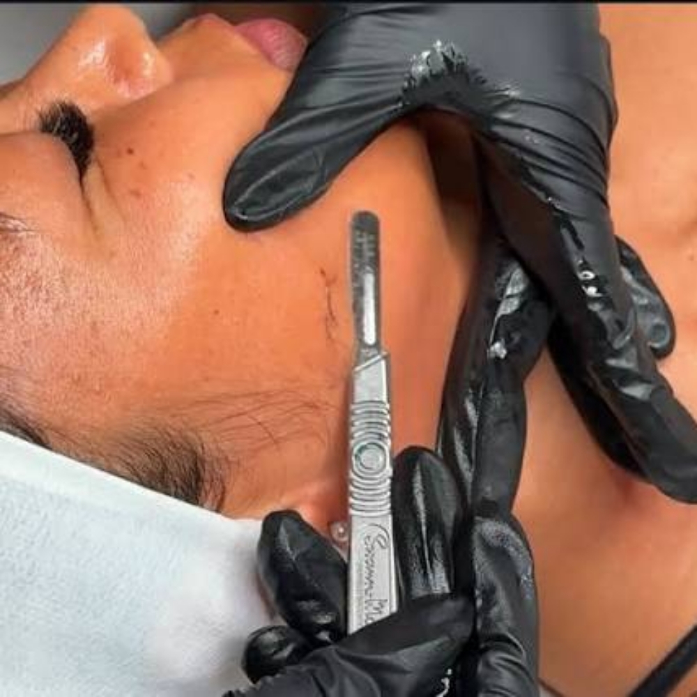 ✨️Deal Of The Month #3✨ Dermaplane at LexGlo Esthetics in Idaho Falls, ID