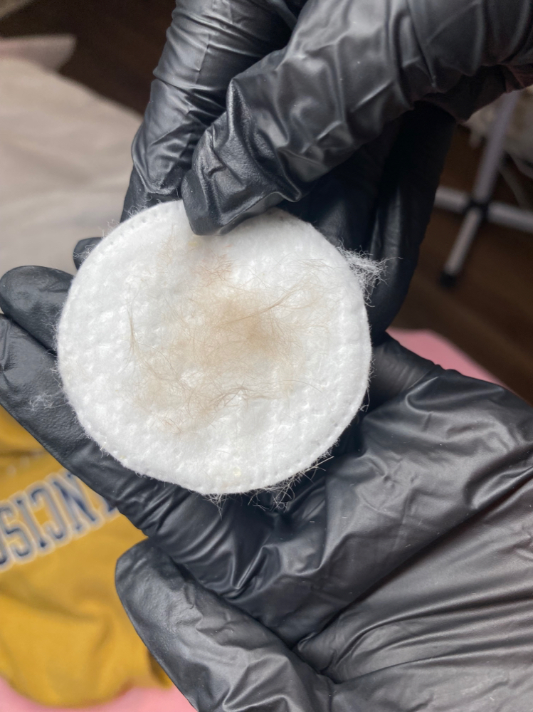 Dermaplane at Glow with Pho in Wilmington, MA