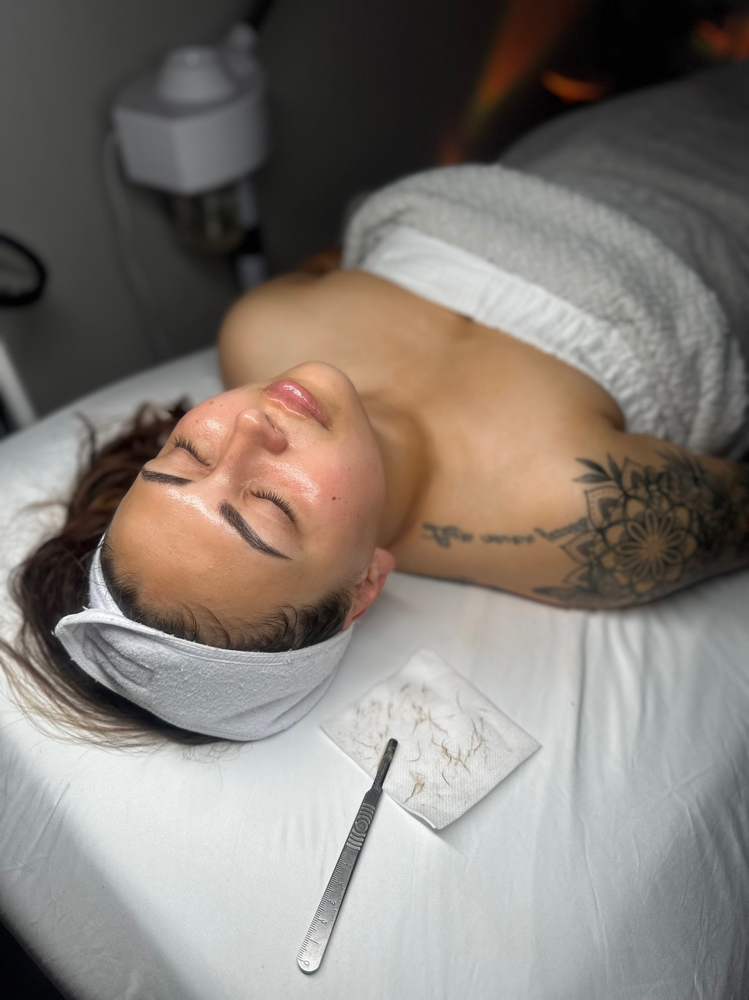 Dermaplaning Facial