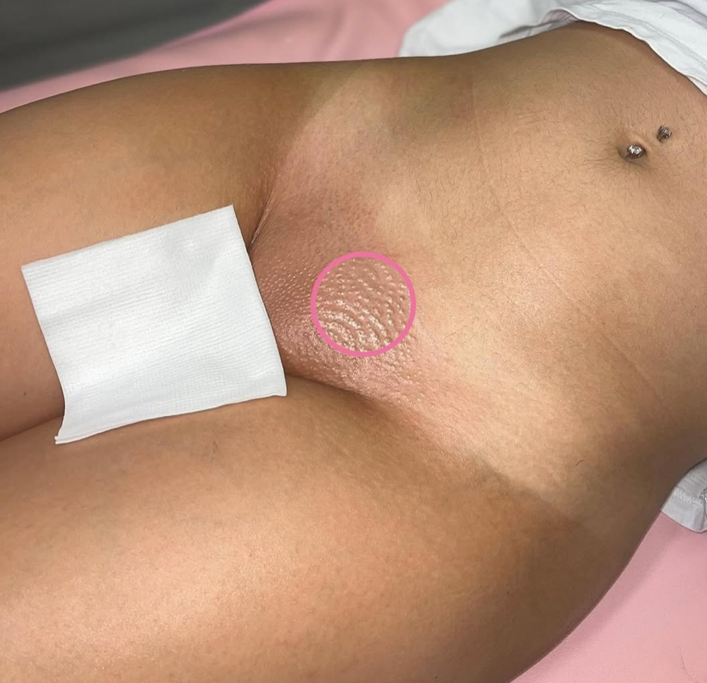 AFNC Signature Brazilian Wax