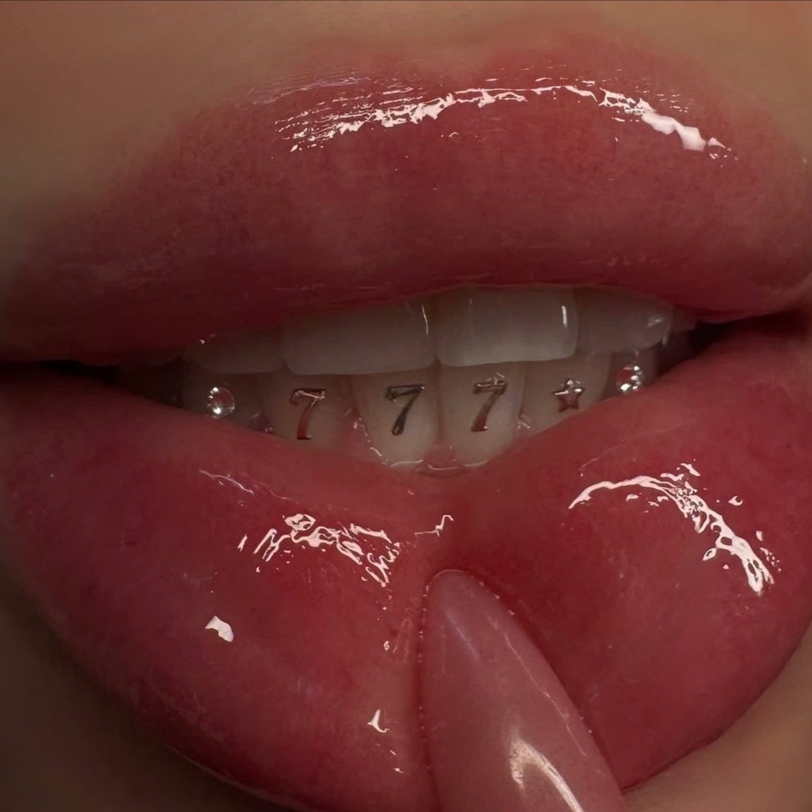 18K Gold Tooth Jewelry at Royal Blanc Smiles - Teeth Whitening and Tooth Gems in Charlotte, NC in Charlotte, NC