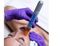 Nano Needling Facial With Enzyme