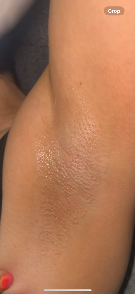 Underarm Wax