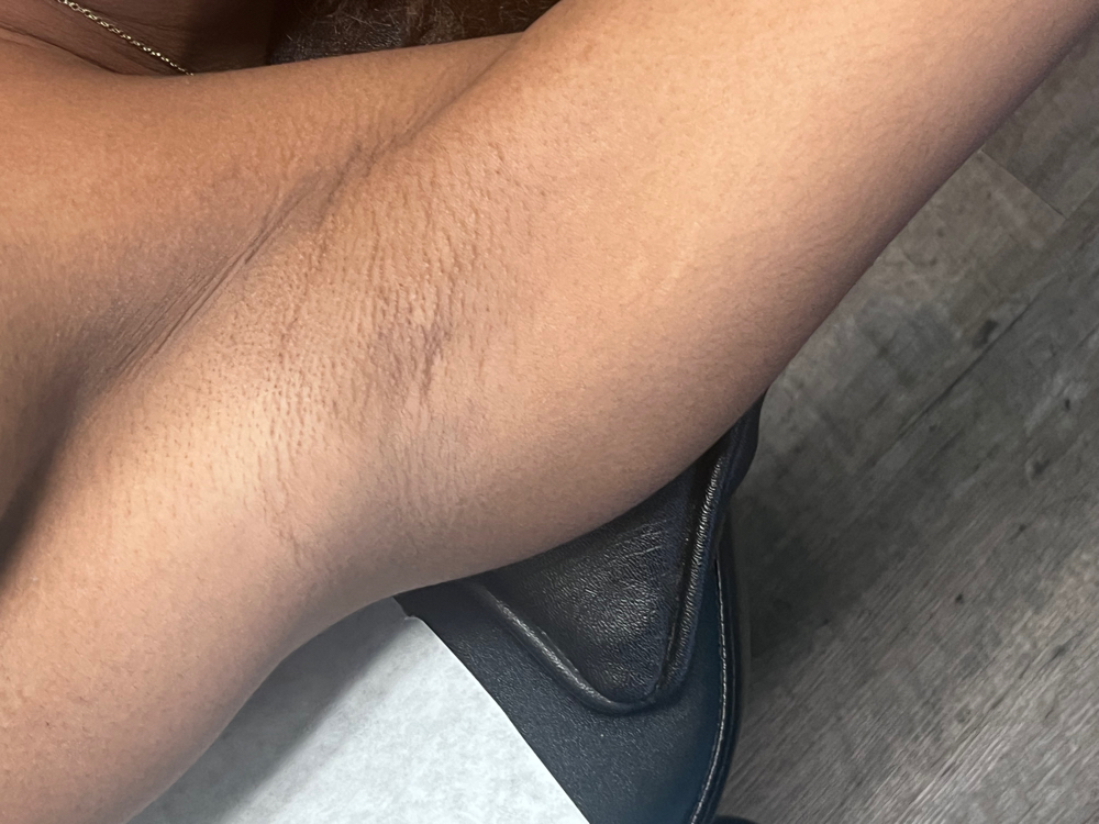 Underarm Wax