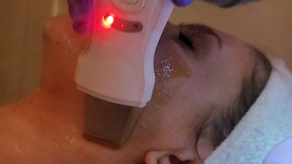 Ultra Sonic Spatula (Acne Facial)