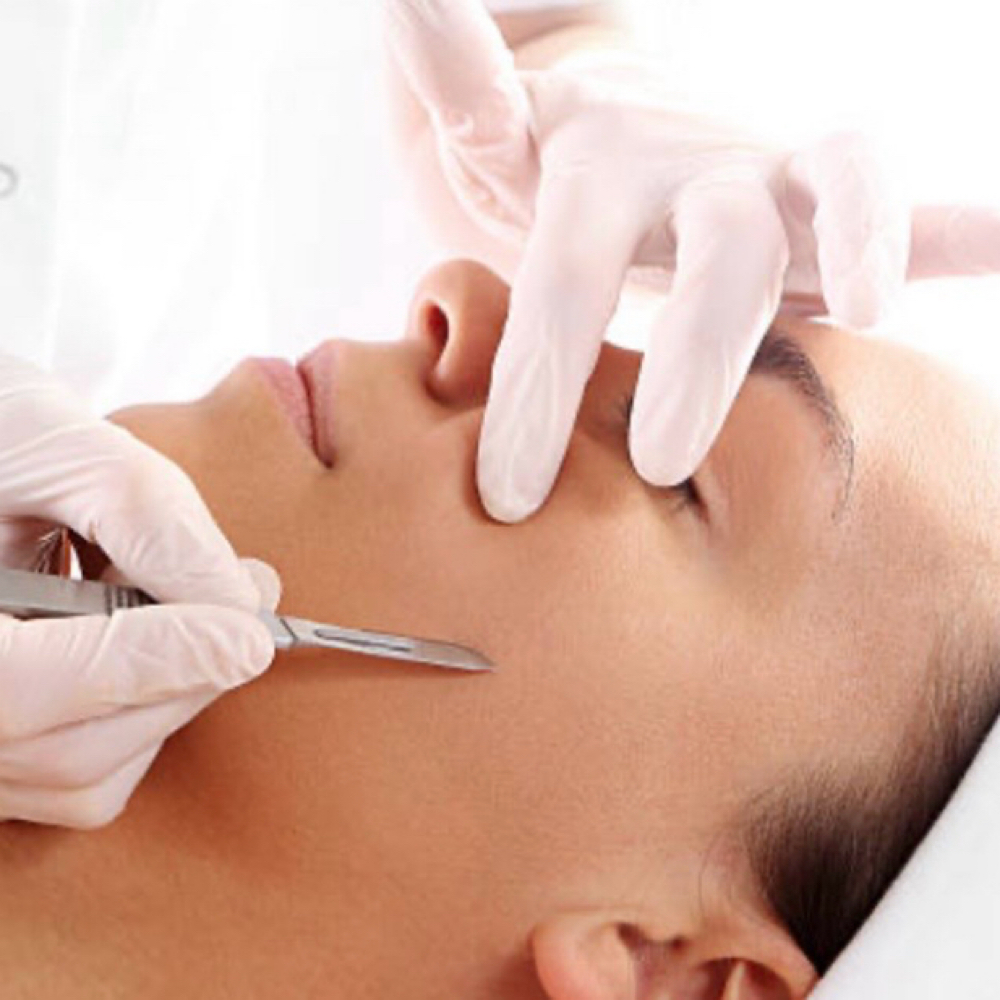 Mini Dermaplane Facial at June Aesthetics in Spring Hill, KS