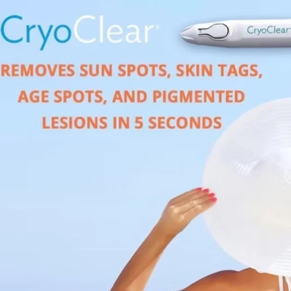 CryoClear- sun/age spots, skin tags at Expressions by Dawn - High Ridge Studio in High Ridge, MO