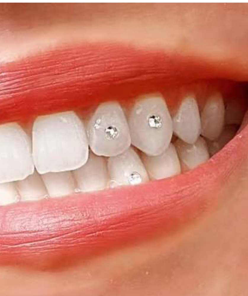 Tooth Gems at Beauty Essence LLC in Commerce City, CO