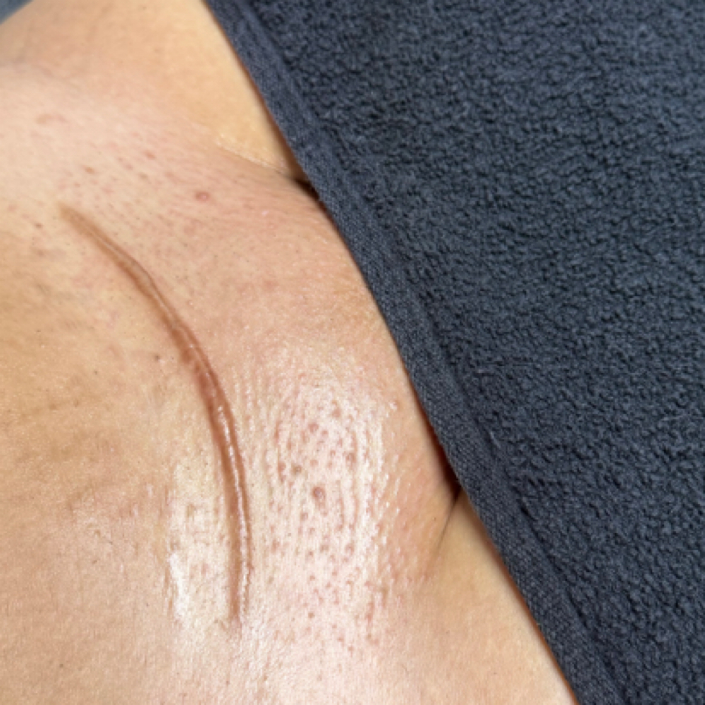 Full Brazilian Wax at AV Esthetics in Leesburg, FL