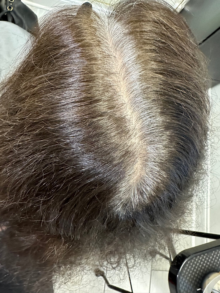 Regrowth Retouch Color