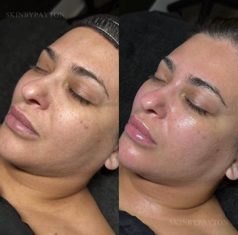 Platinum Customized Facial