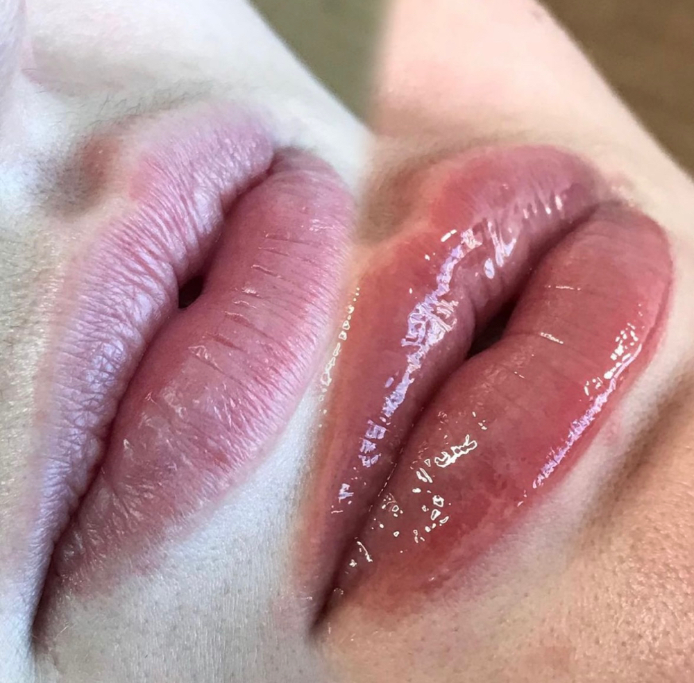 Hydra Gloss lips