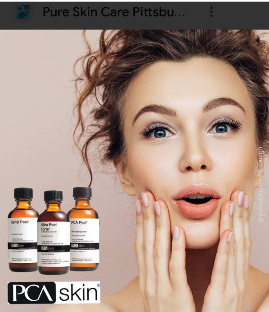 One Layer of Peel at Skin By Shelly in Port Washington, WI