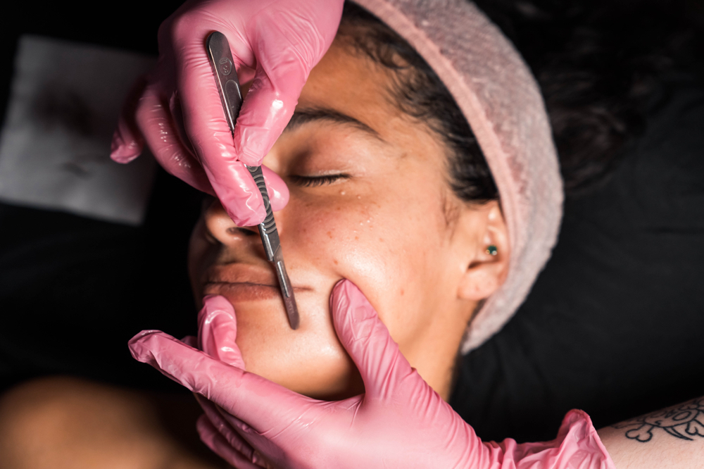 Dermaplane Facial