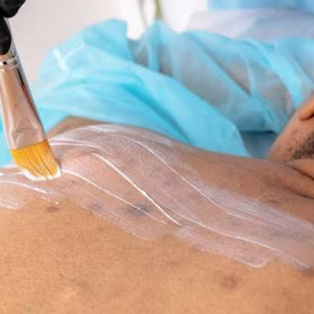 Back Facial at B. Rucker Beauty Co. in Hendersonville, TN