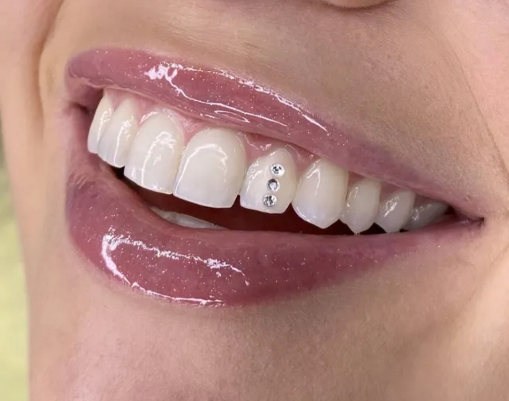3 Teeth Gems