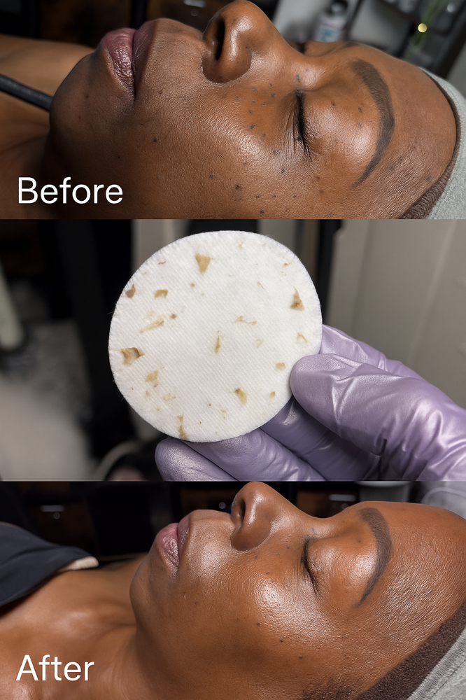 Signature Corrective Facial