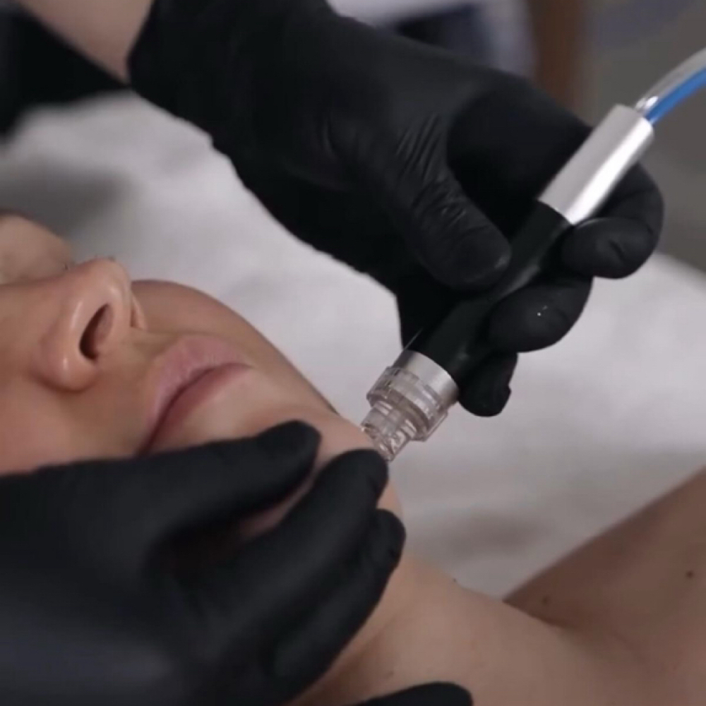 Deluxe Hydrofacial at Waxed By Brittney in Modesto, CA