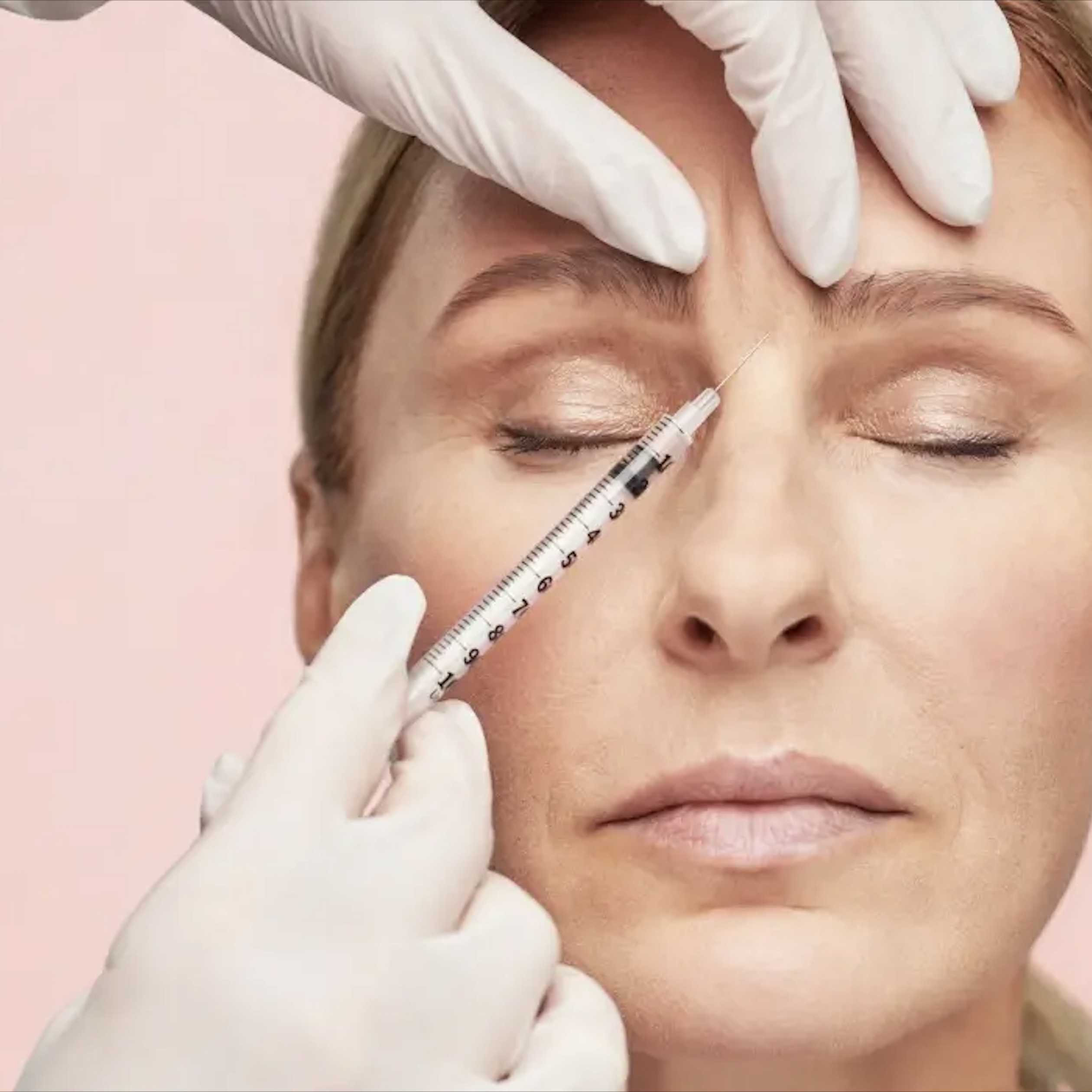PRP - Platelet Rich Plasma Facial
