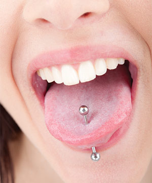 Tongue