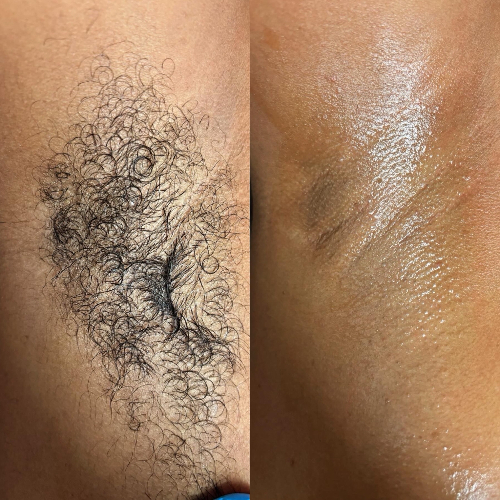 Underarm Wax