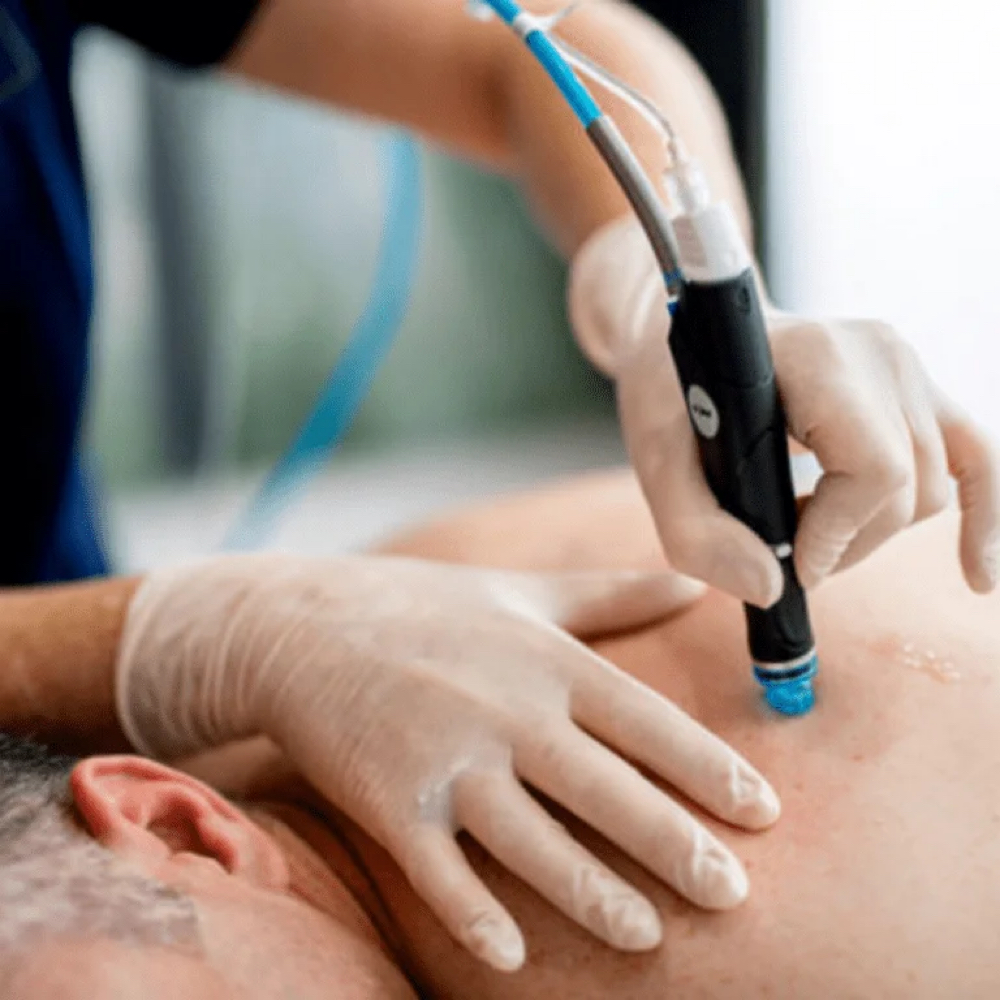 Hydrafacial- Full Back at Skintology Apothecary in Tyler, TX