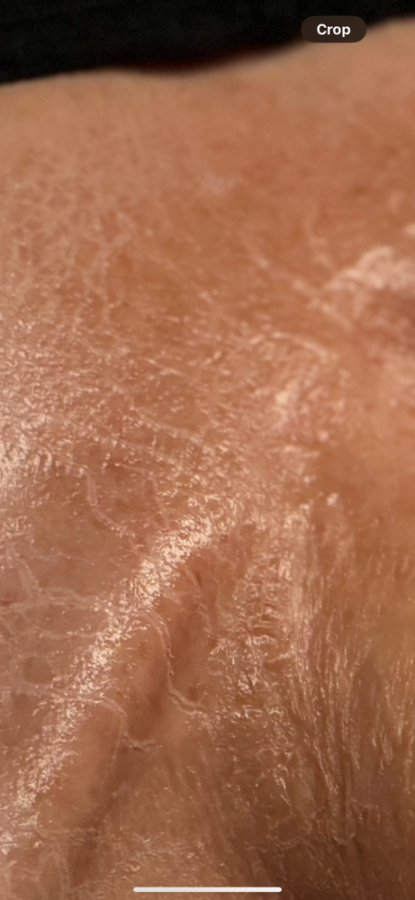 Anti Aging Facial