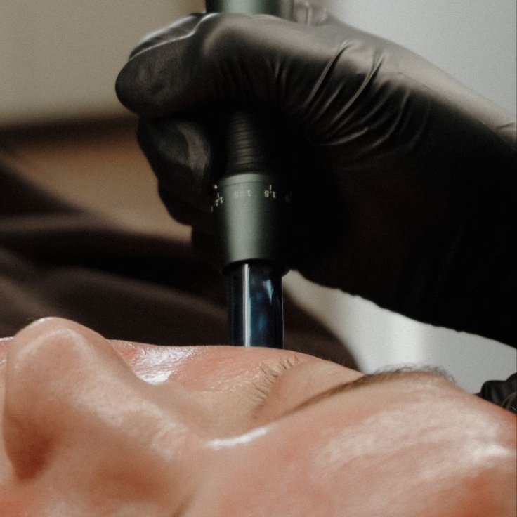 Dermapen microneedling at Beuxtique in Sugar Land, TX