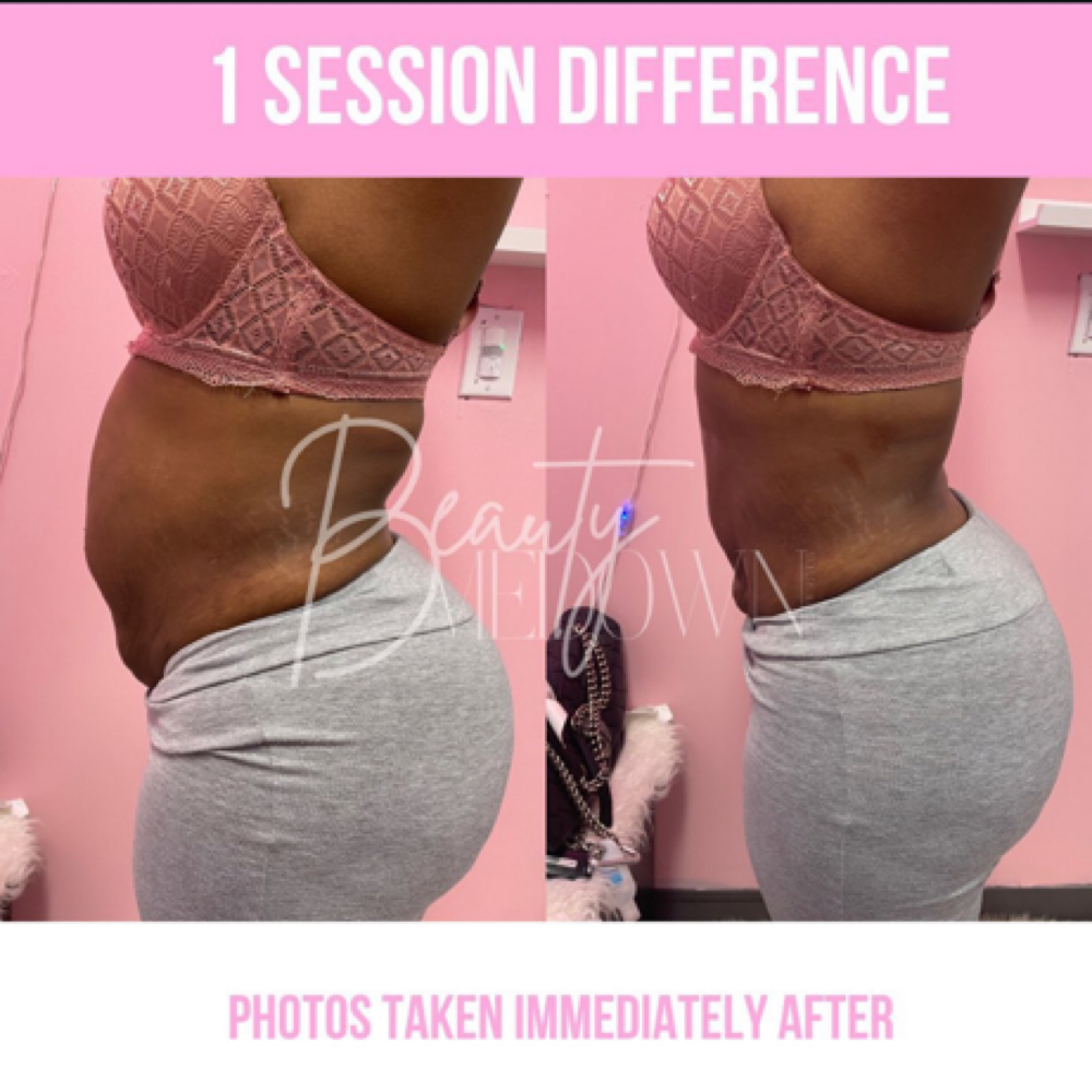 SKIN TIGHTENING at Esthiology Skin Lab in Nottingham, MD