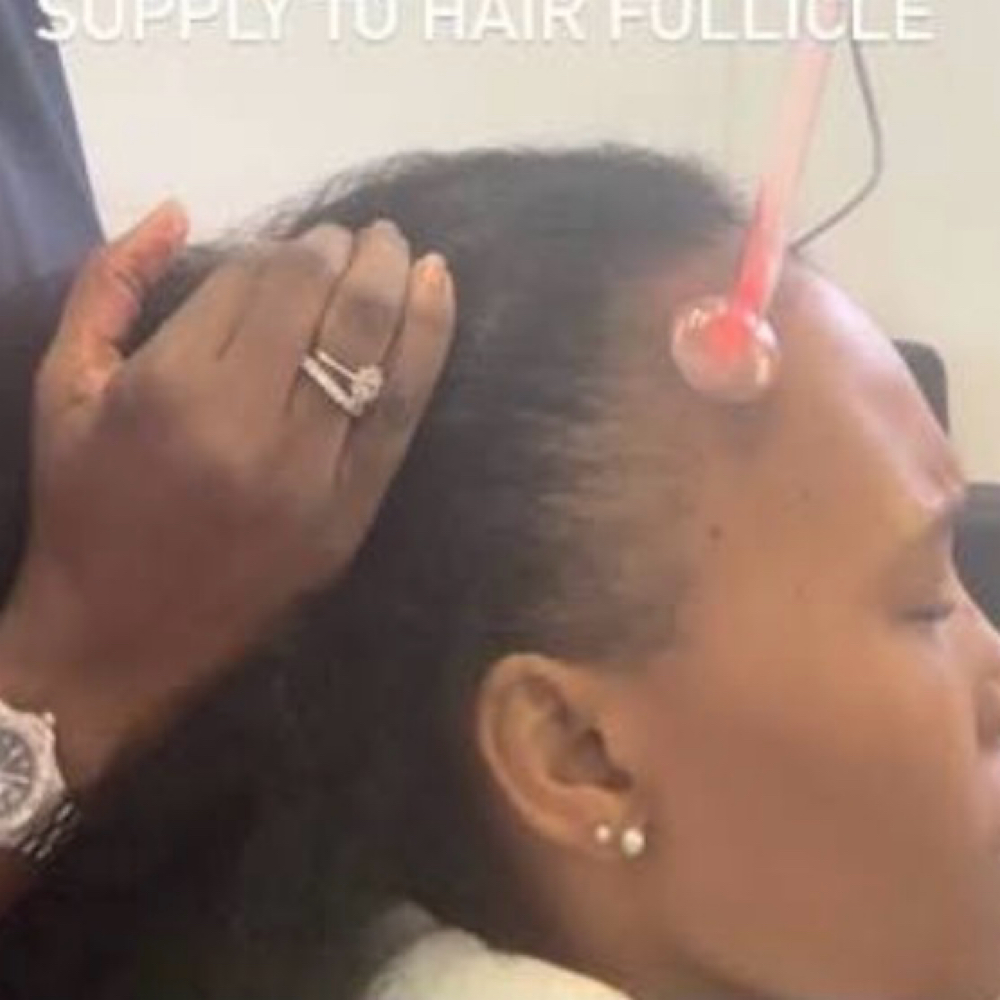 Scalp Facial at Divine Elegance Esthetics LLC in Radcliff, KY