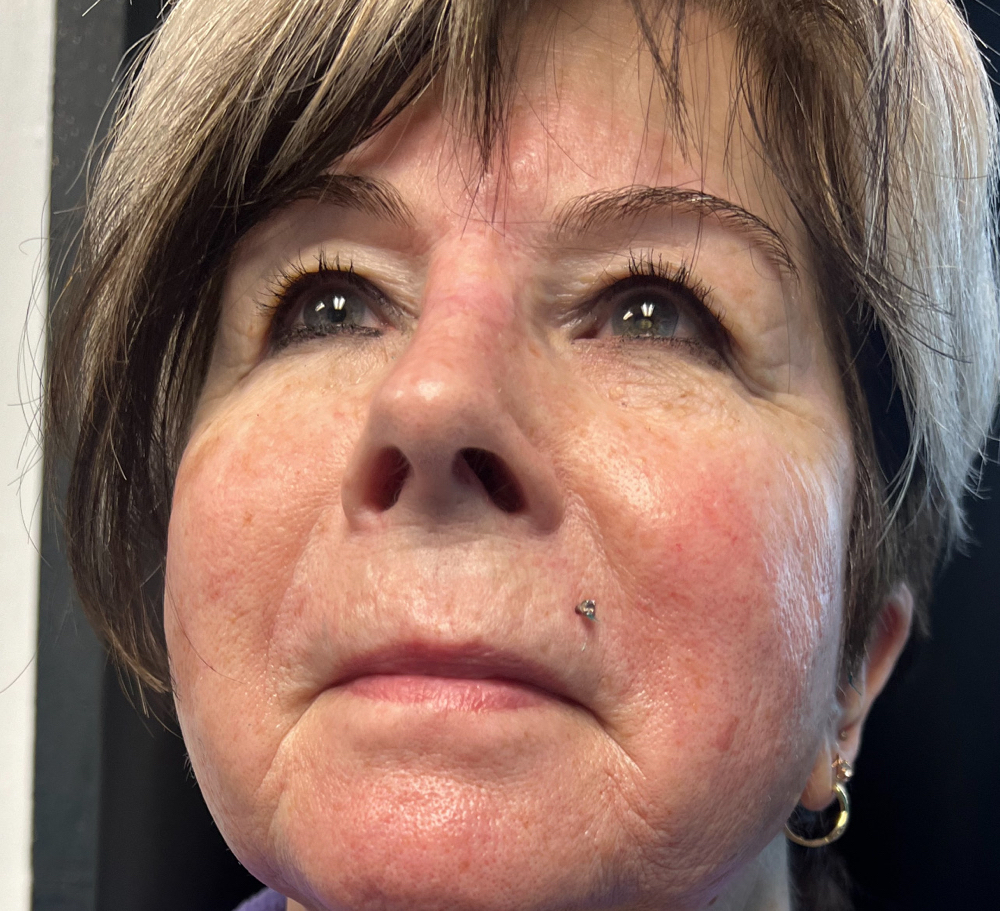 Full Face Wax at Blu Esthetics LLC in Rochester, NY