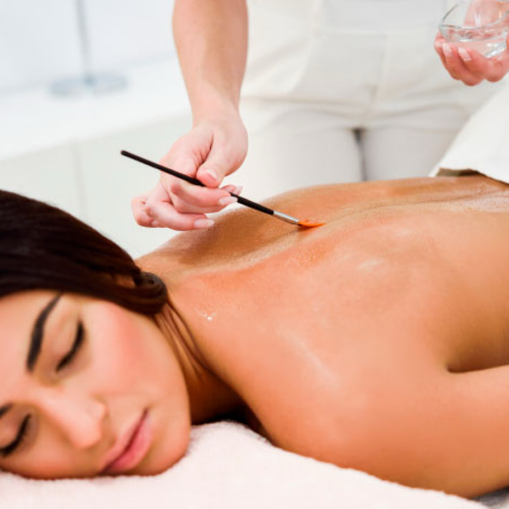 Back Treatment at Nude Skin Aesthetics in San Pedro, CA