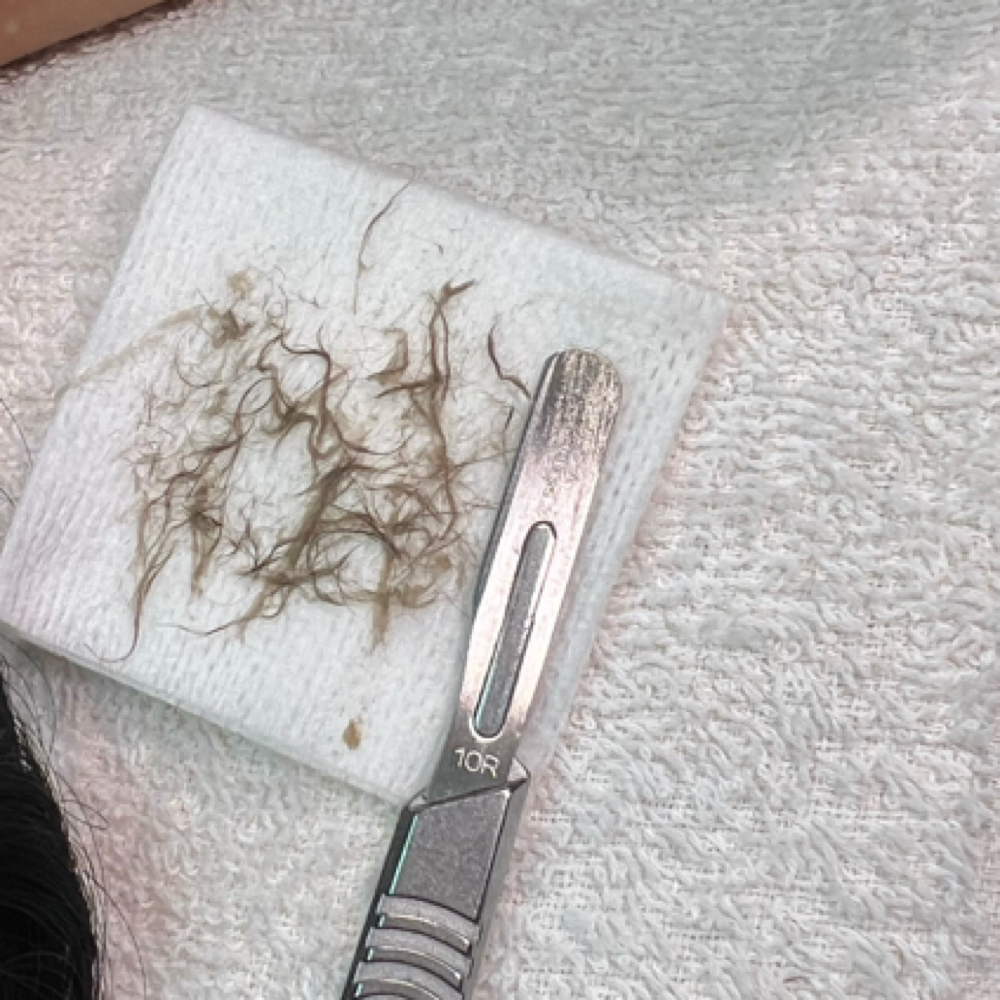 3 Month Dermaplane Facail Package at The Este Lounge in Hanford, CA